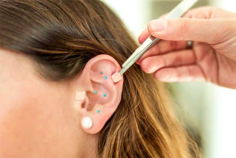 Curso de Auriculoterapia